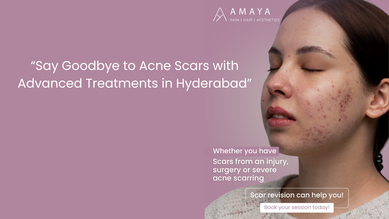 Best Acne Scar Treatment in Madhapur & Jubilee Hills, Hyderabad – Amaya Skin Clinic